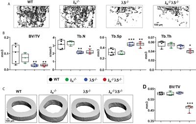 Loss of early B cell protein λ5 decreases bone mass and accelerates skeletal aging